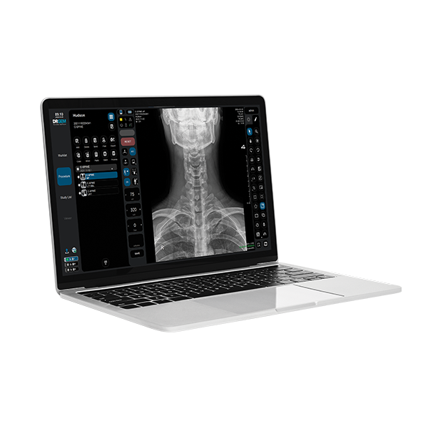 RADMAX